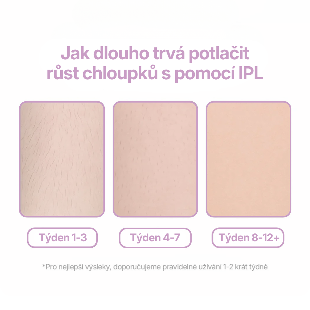 Glazie IPL Epilátor + ochranné brýle zdarma