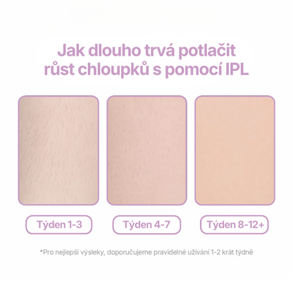 Glazie IPL Epilátor + ochranné brýle zdarma