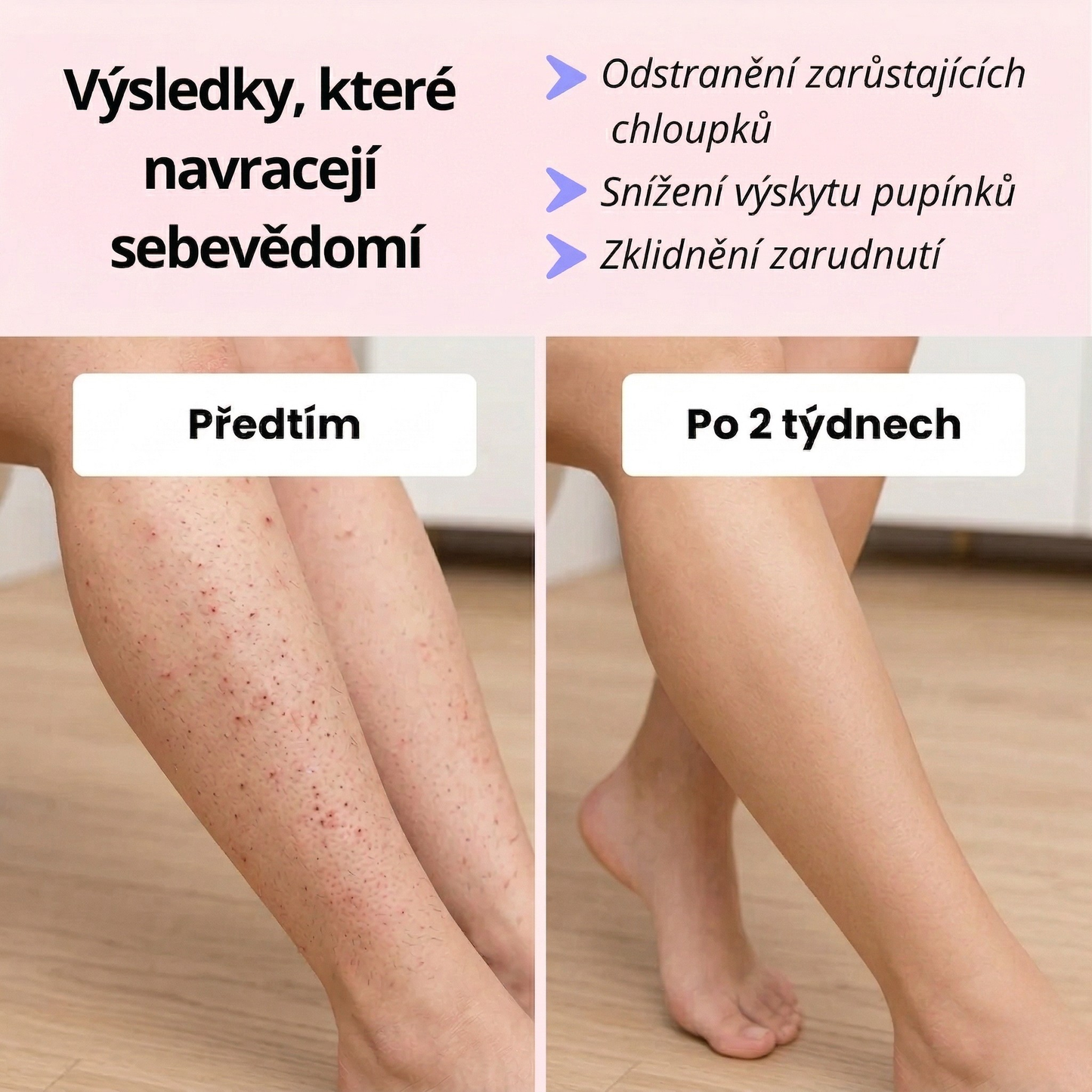 Glazie™ IPL Epilátor + ochranné brýle zdarma