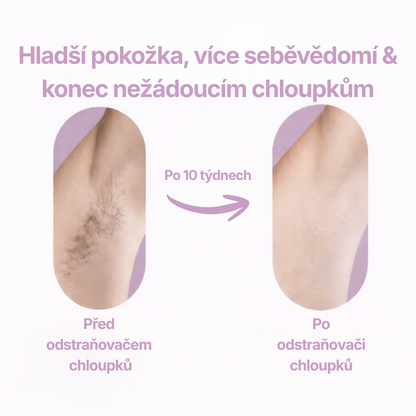 Glazie IPL Epilátor + ochranné brýle zdarma